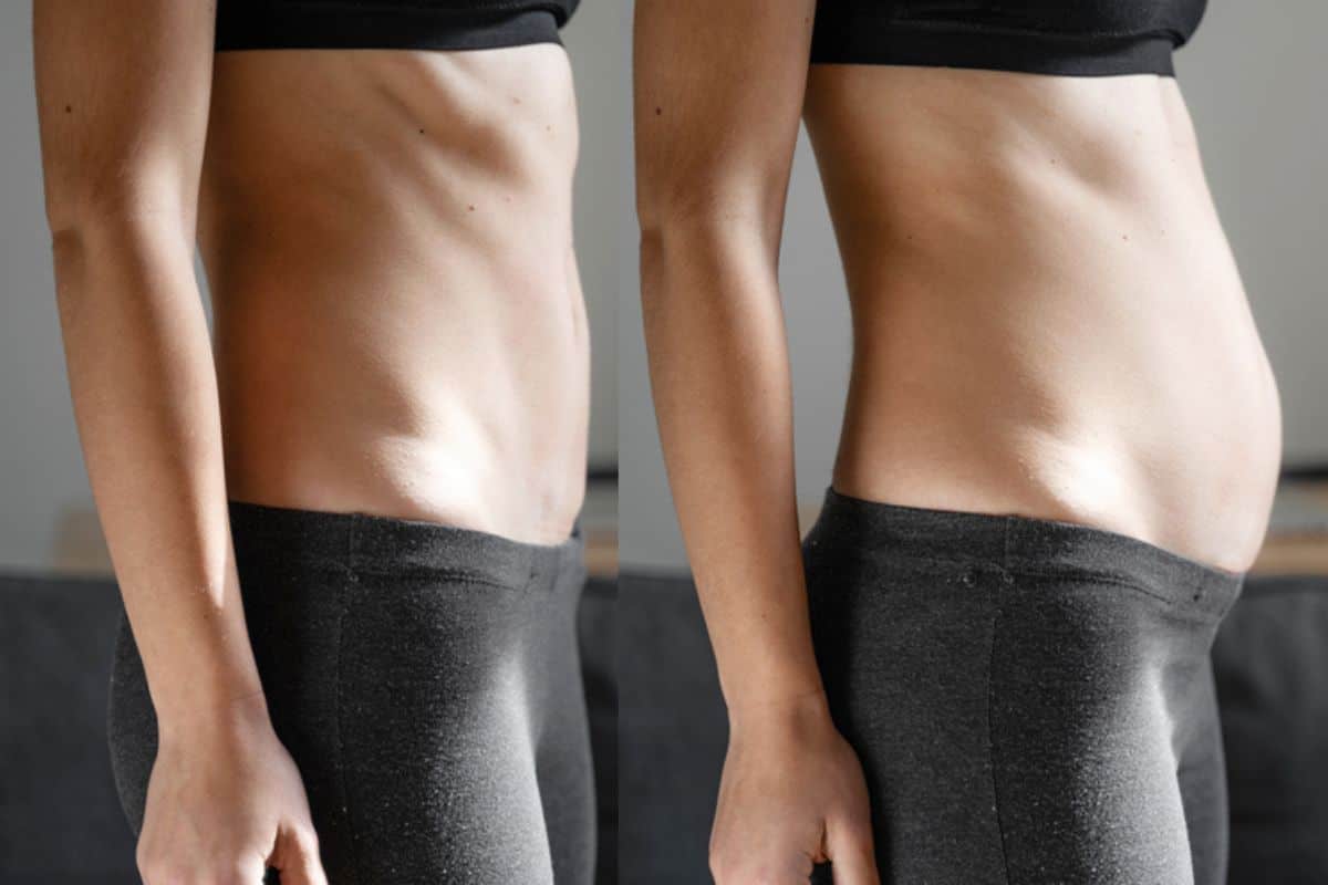 How long does diastasis recti take to improve West Ealing?