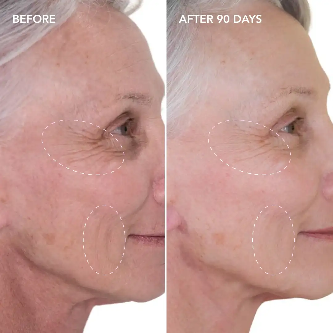 When will you see results West Ealing